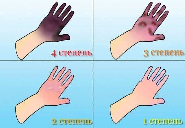 Obmor